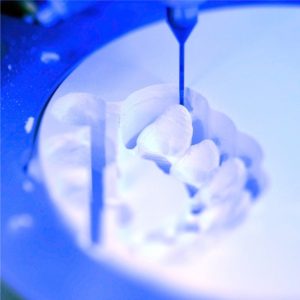 Prosthetics and Tooth Replacement01
